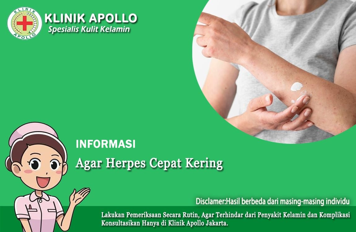 Ilustrasi Cara Agar Herpes Cepat Kering