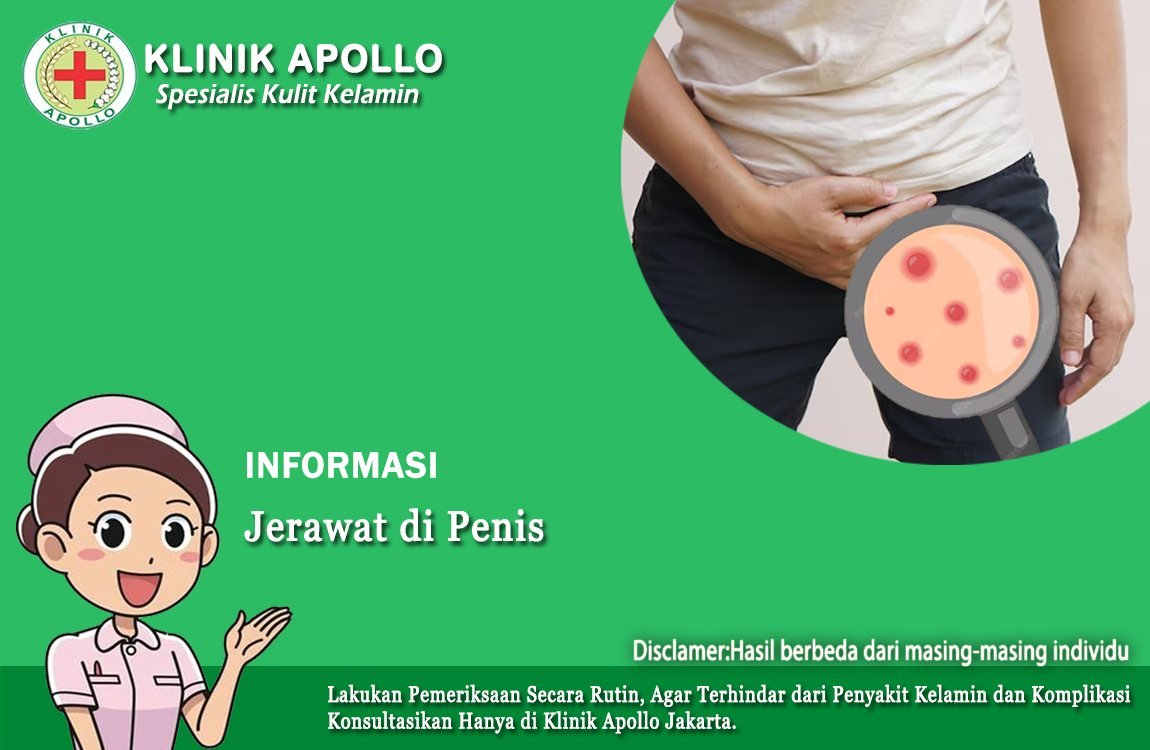 Ada Jerawat yang Tumbuh di Penis? Begini Pengobatannya