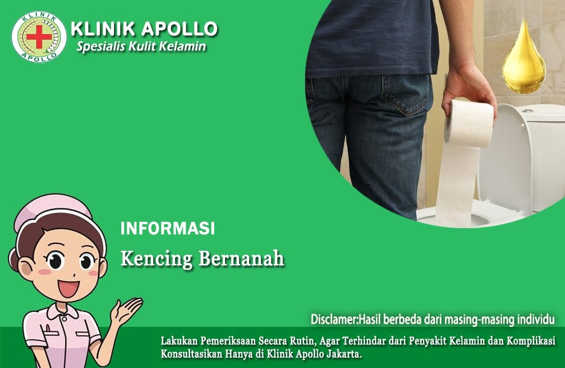 Laki-Laki Bisa Kena Kencing Bernanah, Atasi Penyebabnya