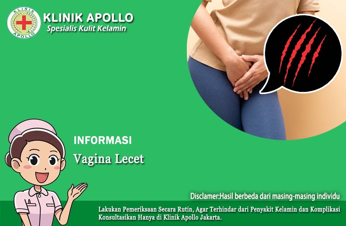 Vagina Anda Lecet? Bisa Jadi karena Ini, Cepat Atasi!