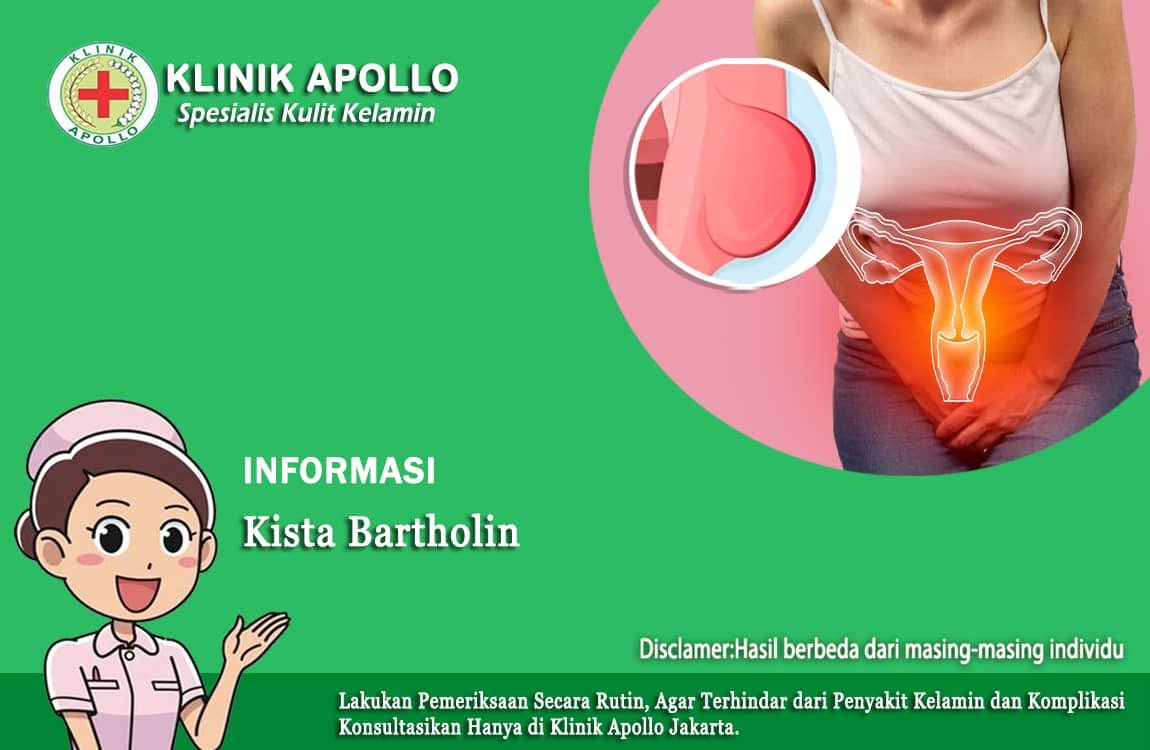 Wanita dengan kista bartholin segera lakukan pemeriksaan dan penanganan lebih lanjut dengan dokter ahli ginekologi.